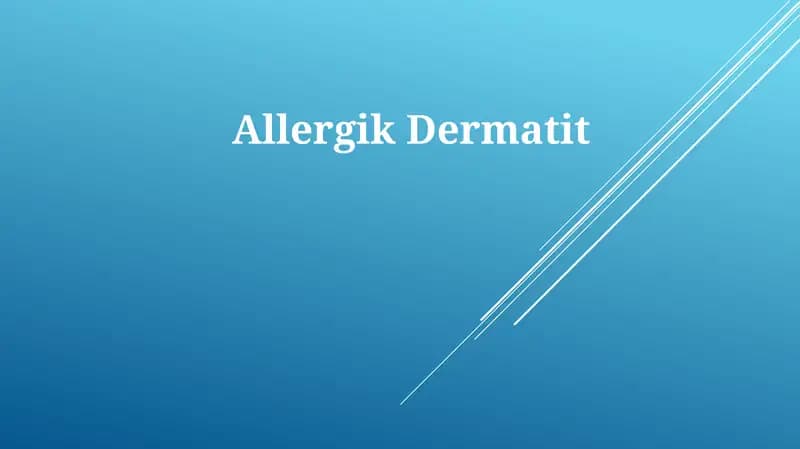 AllergikDermatit