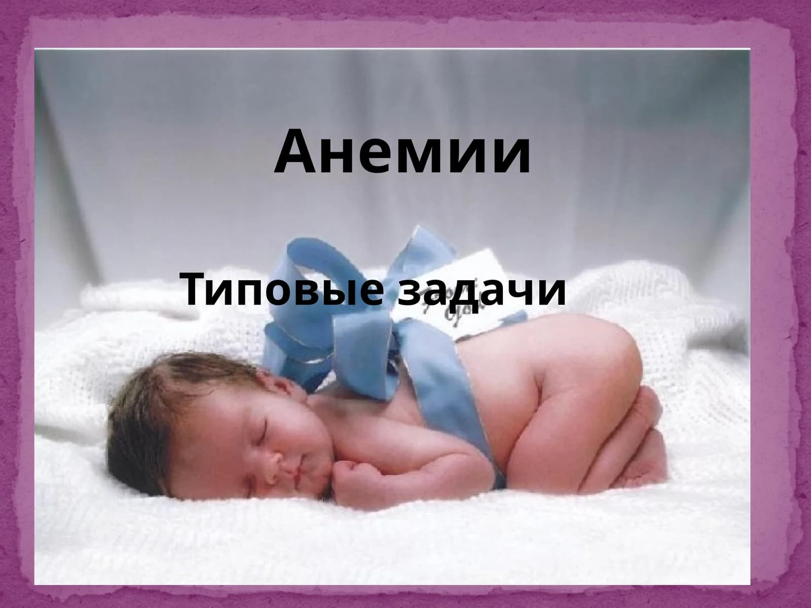 Анемии