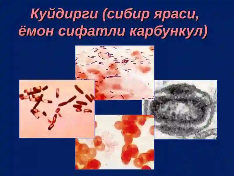 Куйдирги (Bacillus anthracis)