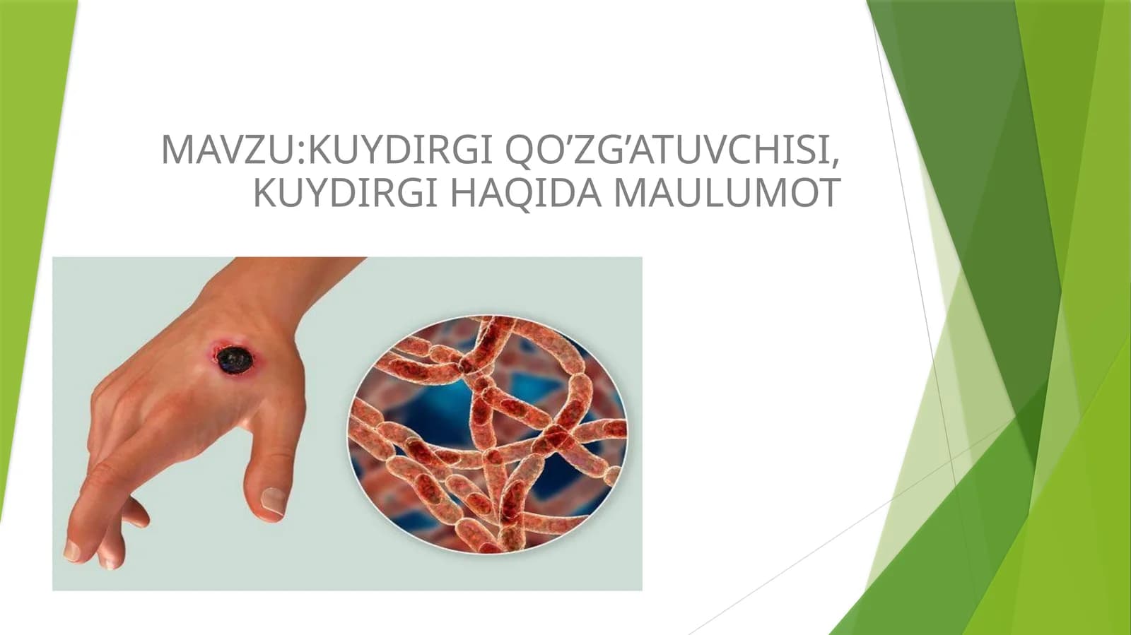 KUYDIRGI QO’ZG’ATUVCHISI, KUYDIRGI HAQIDA MA‘LUMOT