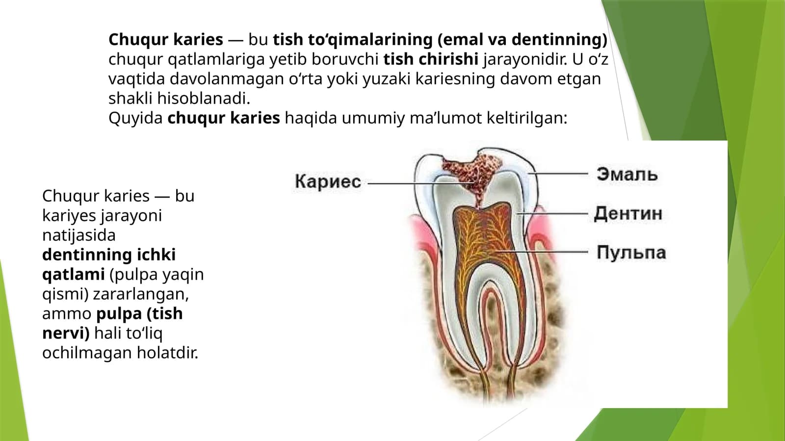 Chuqurkaries