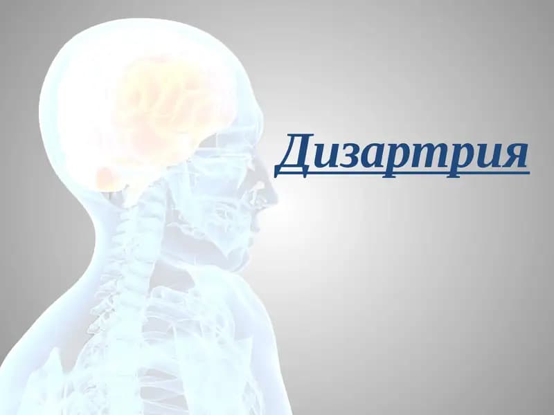 Дизартрия