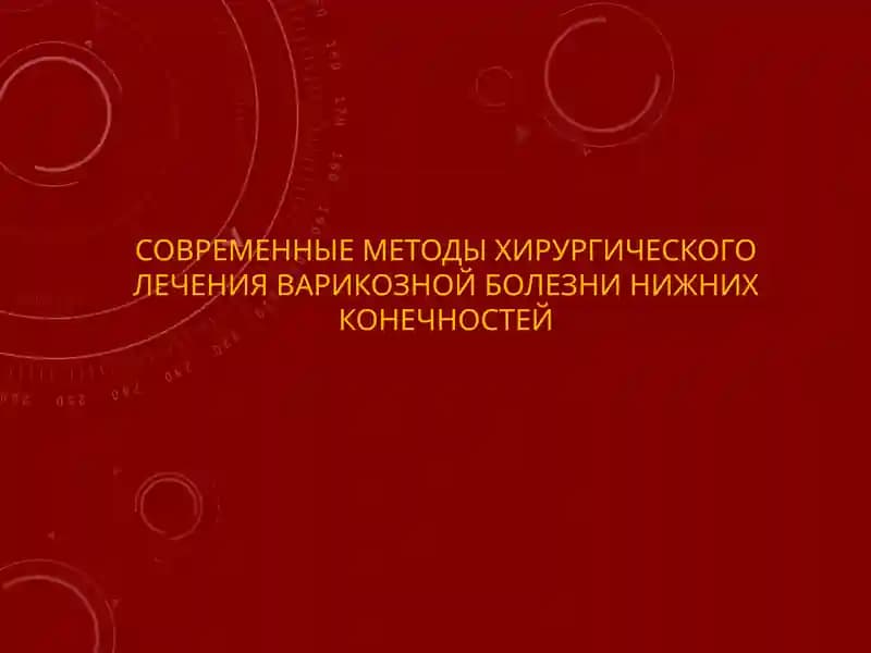 СОВРЕМЕННЫЕ МЕТОДЫ ХИРУРГИЧЕСКОГО ЛЕЧЕНИЯ ВАРИКОЗНОЙ БОЛЕЗНИ НИЖНИХ КОНЕЧНОСТЕЙ