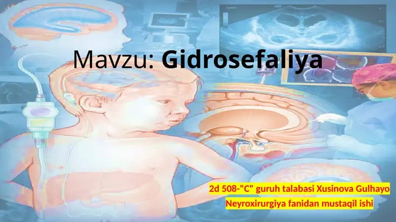 Gidrosefaliya