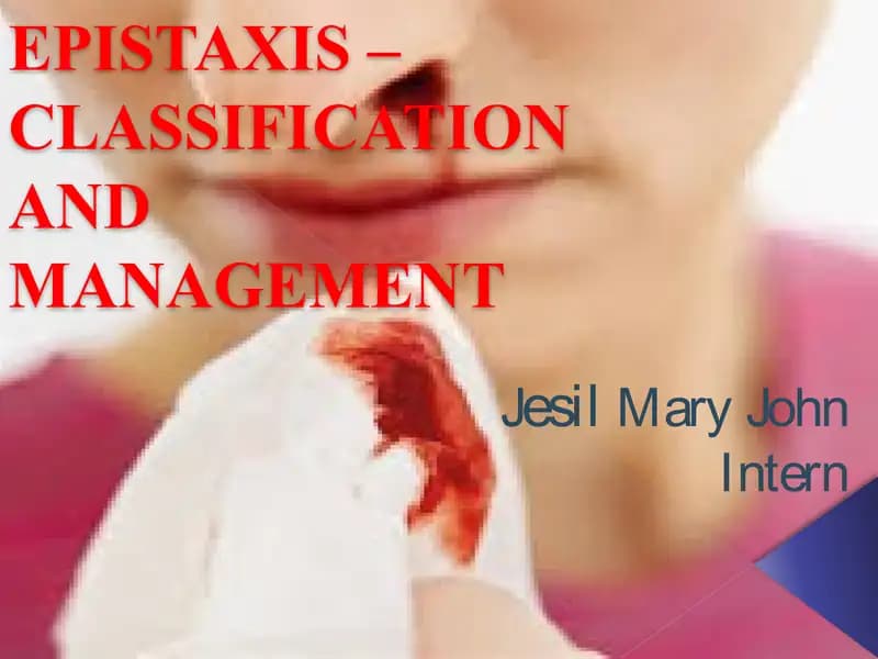 EPISTAXIS – CLASSIFICATION AND MANAGEMENT