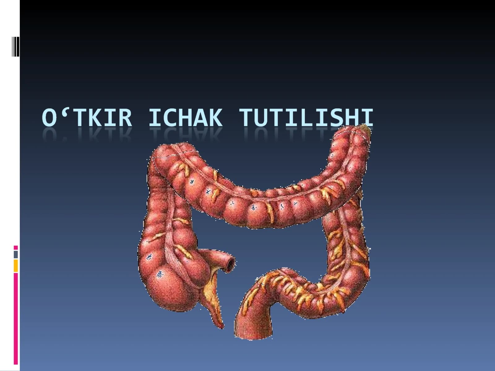Ichak tutilishi