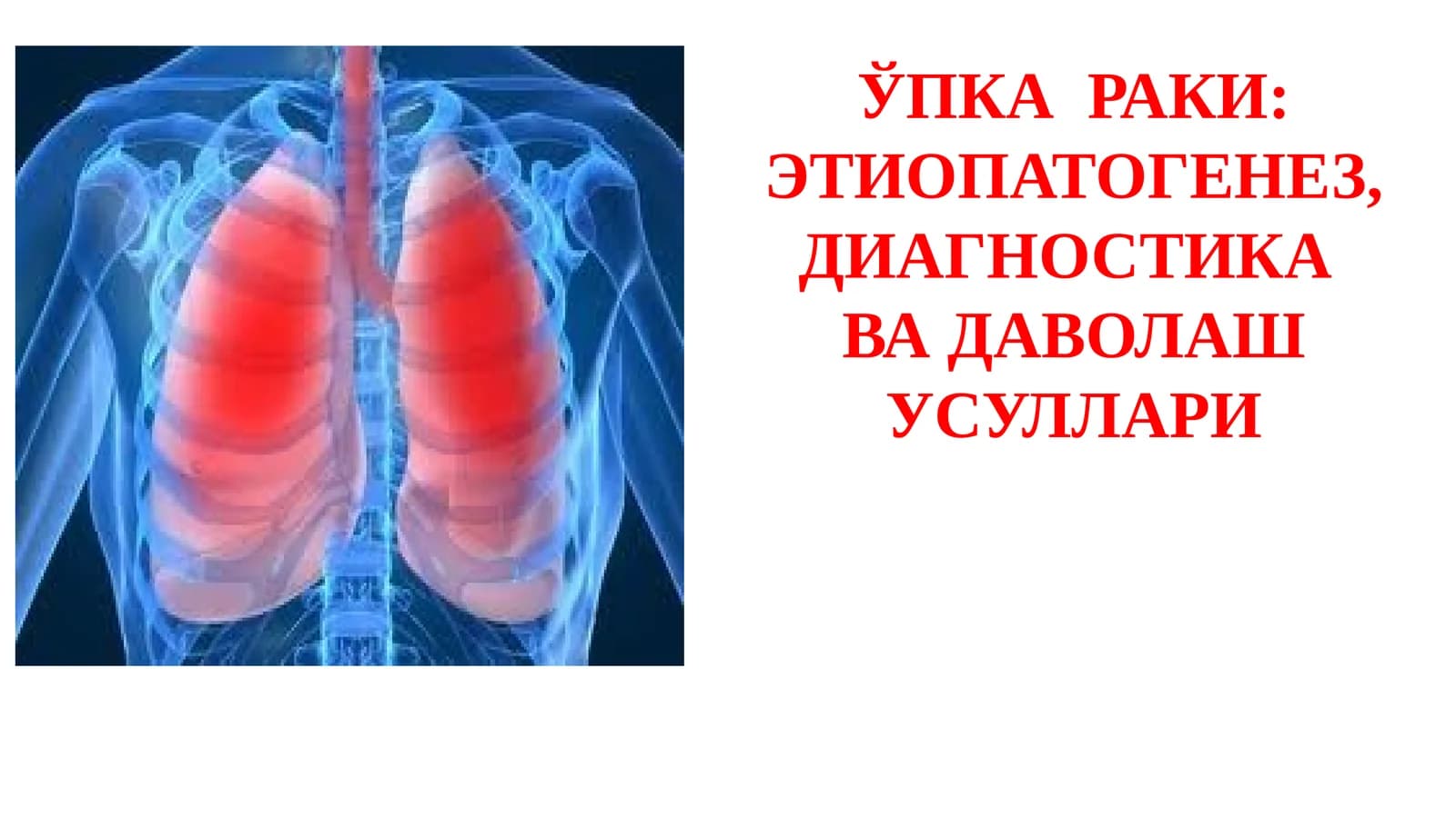 ЎПКА РАКИ