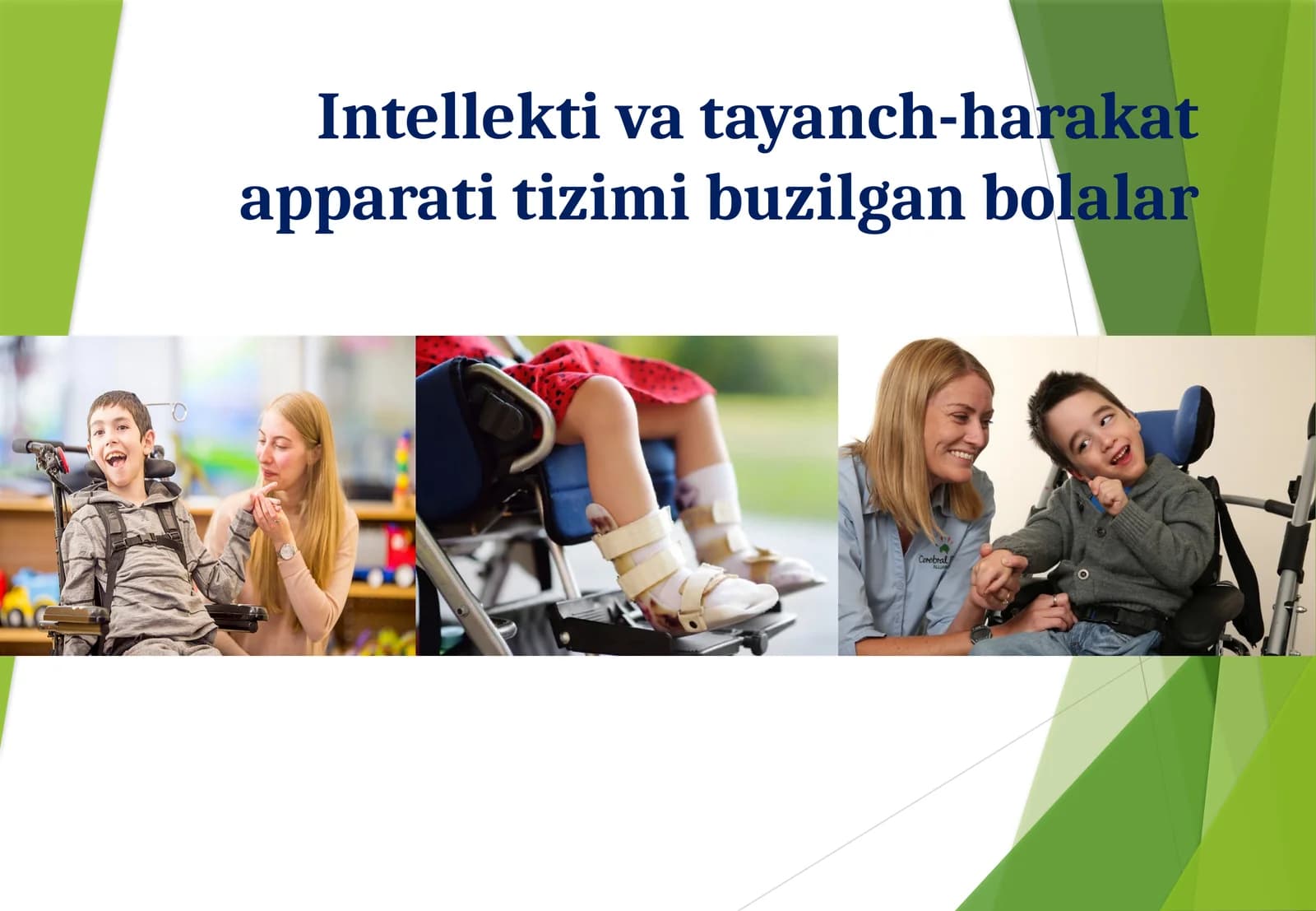 Intellektiva tayanch-harakat apparati tizimi buzilgan bolalar