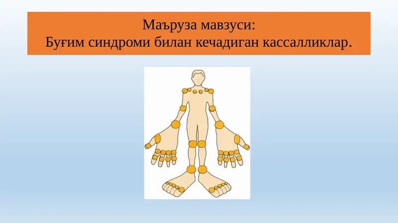 Буғим синдроми билан кечадиган кассалликлар