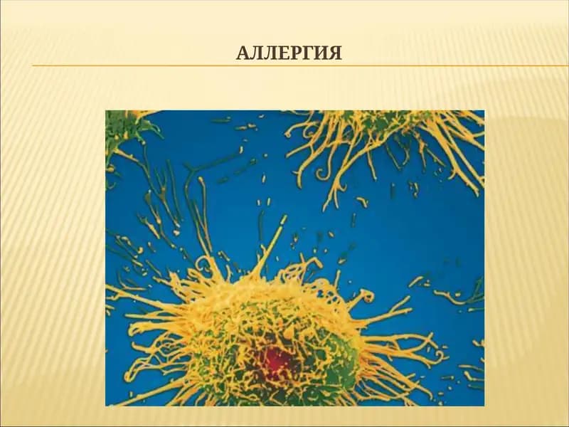 АЛЛЕРГИЯ