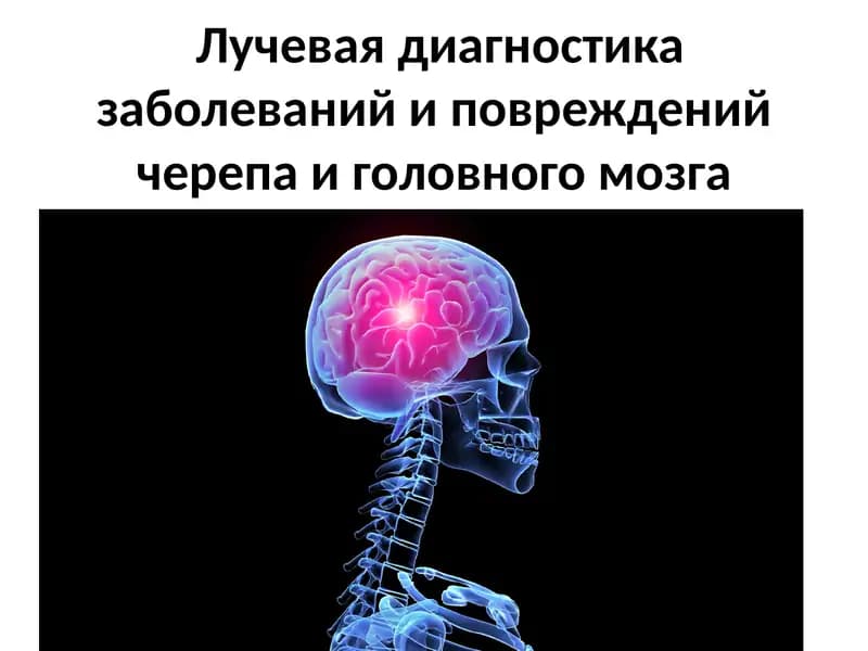 Лучевая диагностика заболеваний и повреждений черепа и головного мозга