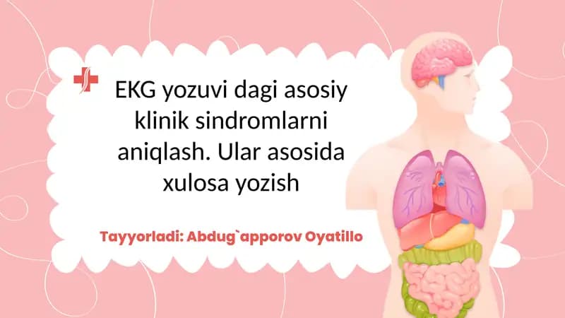 EKG yozuvi dagi asosiy klinik sindromlarni aniqlash. Ular asosida xulosa yozish
