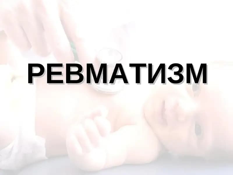 Ревматизм