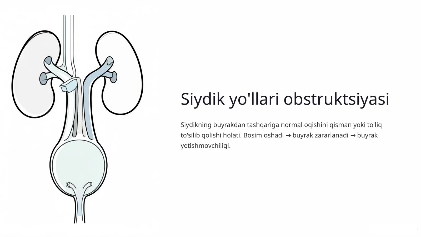 Siydik yo'llari obstruktsiyasi