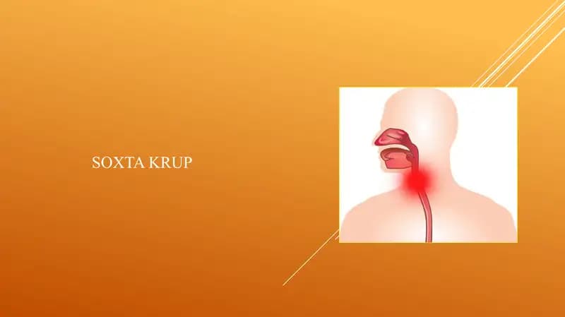 SOXTA KRUP