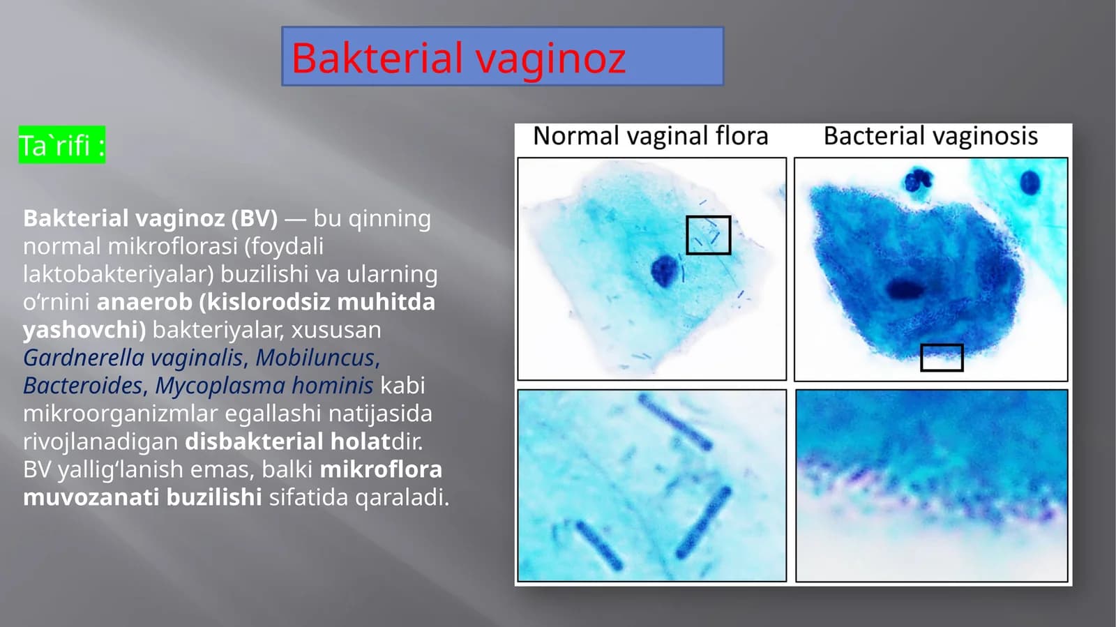 Bakterial vaginoz