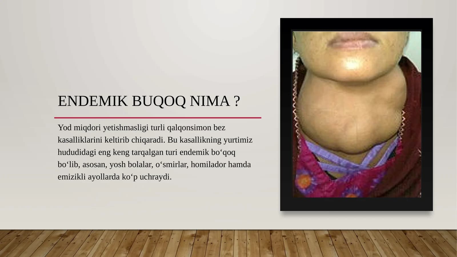 Endemik buqoq biokimyo 13-mavzu