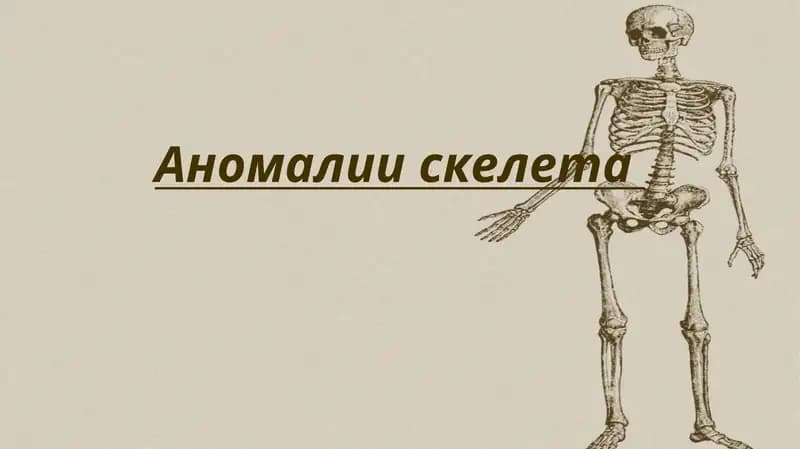 Аномалии скелета