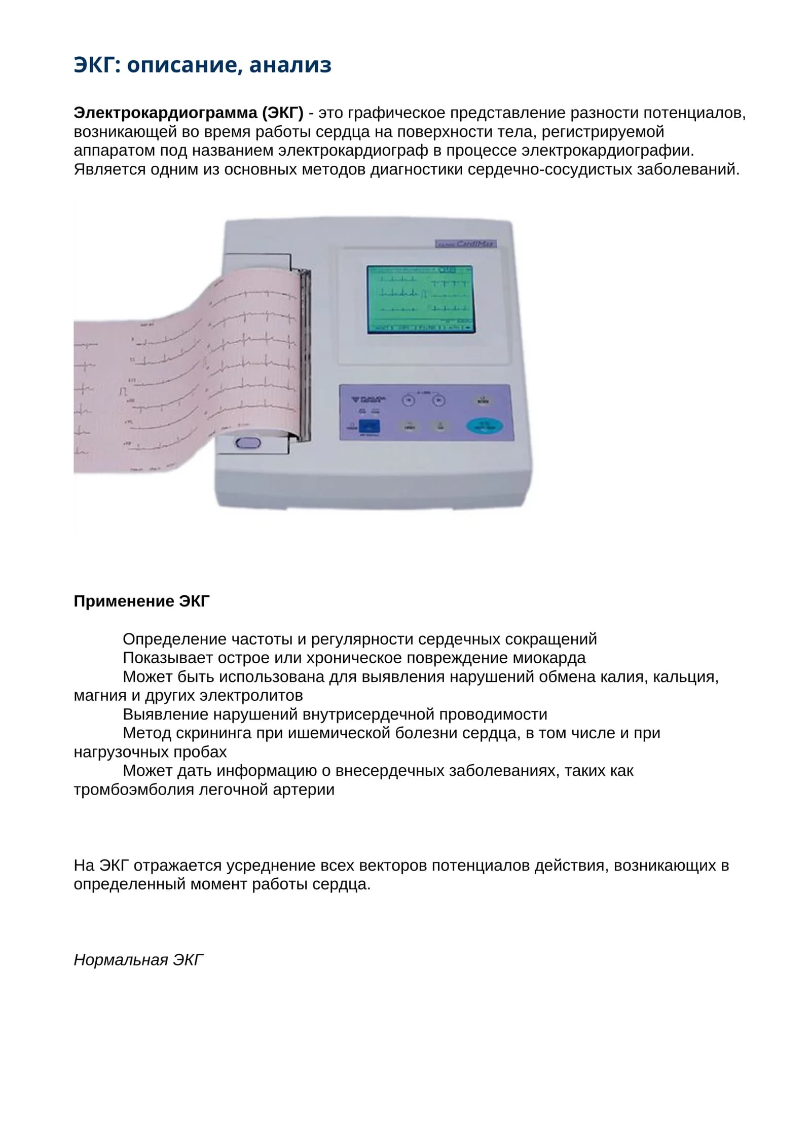 ЭКГ: описание, анализ