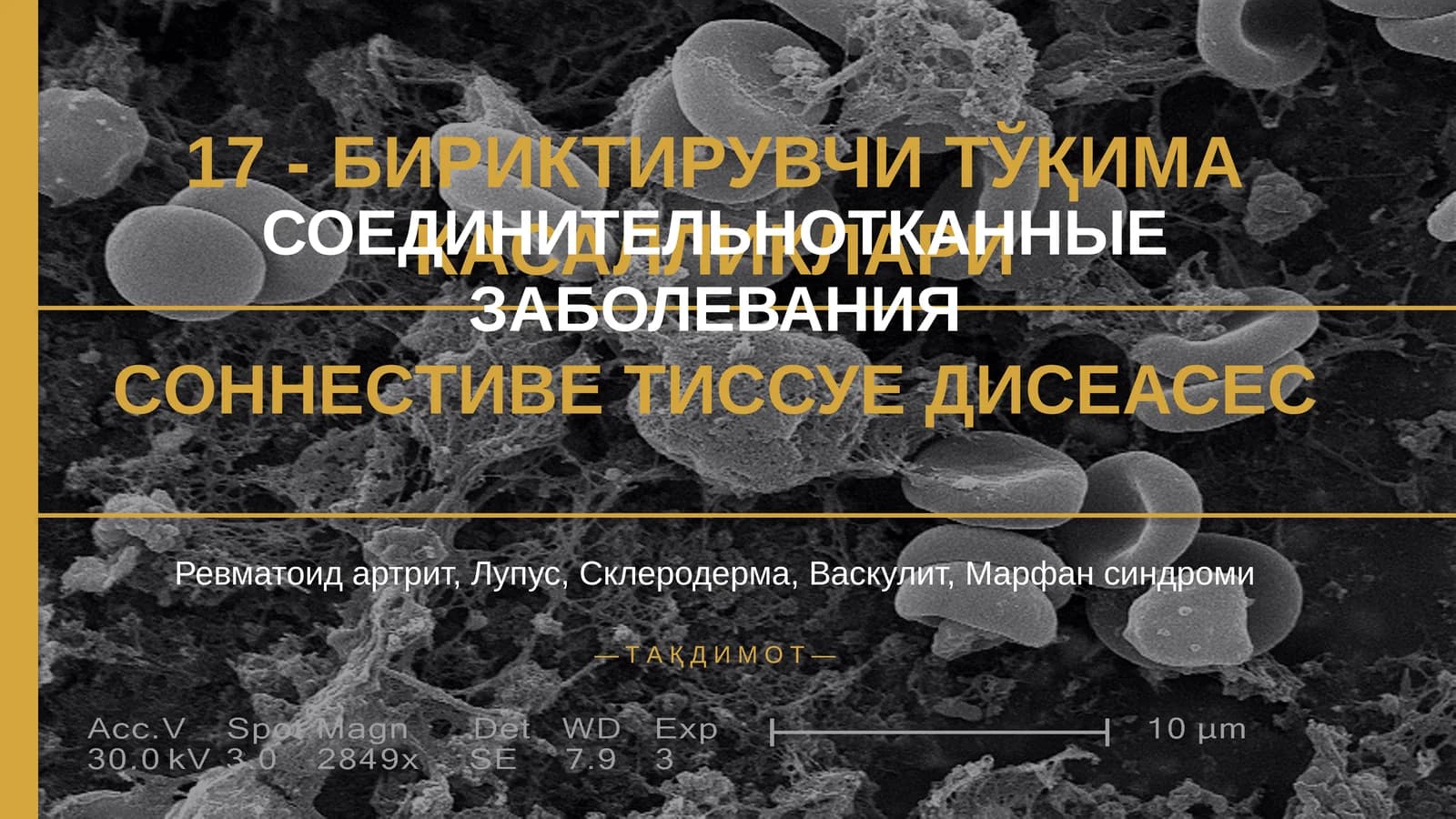 БИРИКТИРУВЧИ ТЎҚИМА КАСАЛЛИКЛАРИ