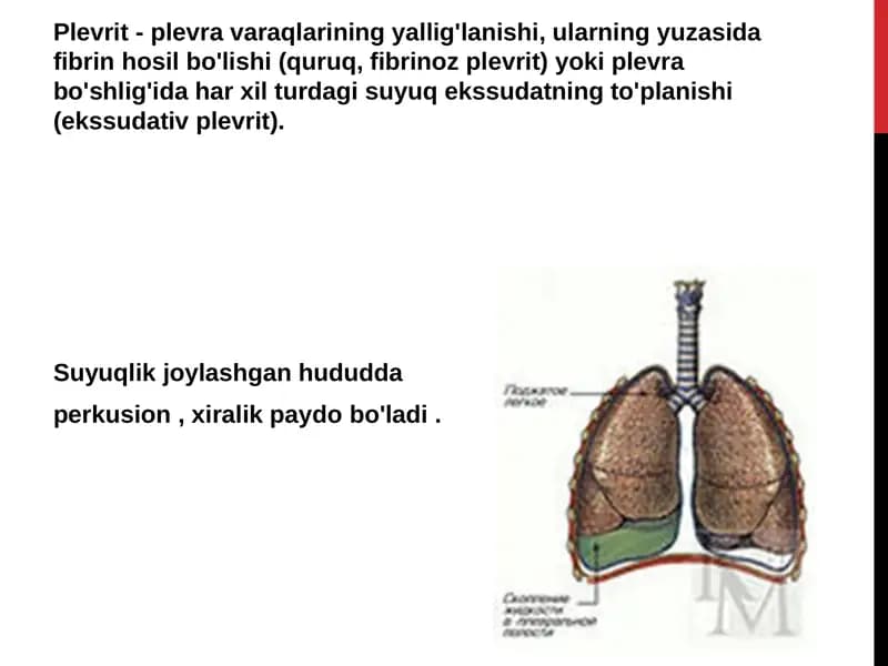 Plevritning tasnifi