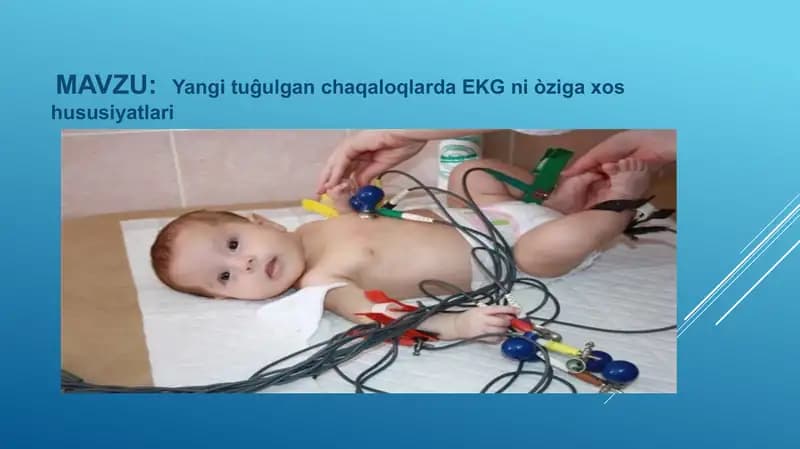 Elektrokardiogramma (EKG)