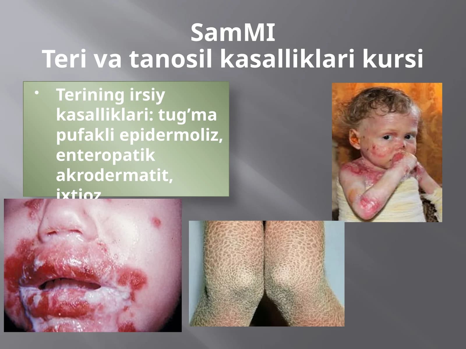 SamMITeri va tanosil kasalliklari kursi