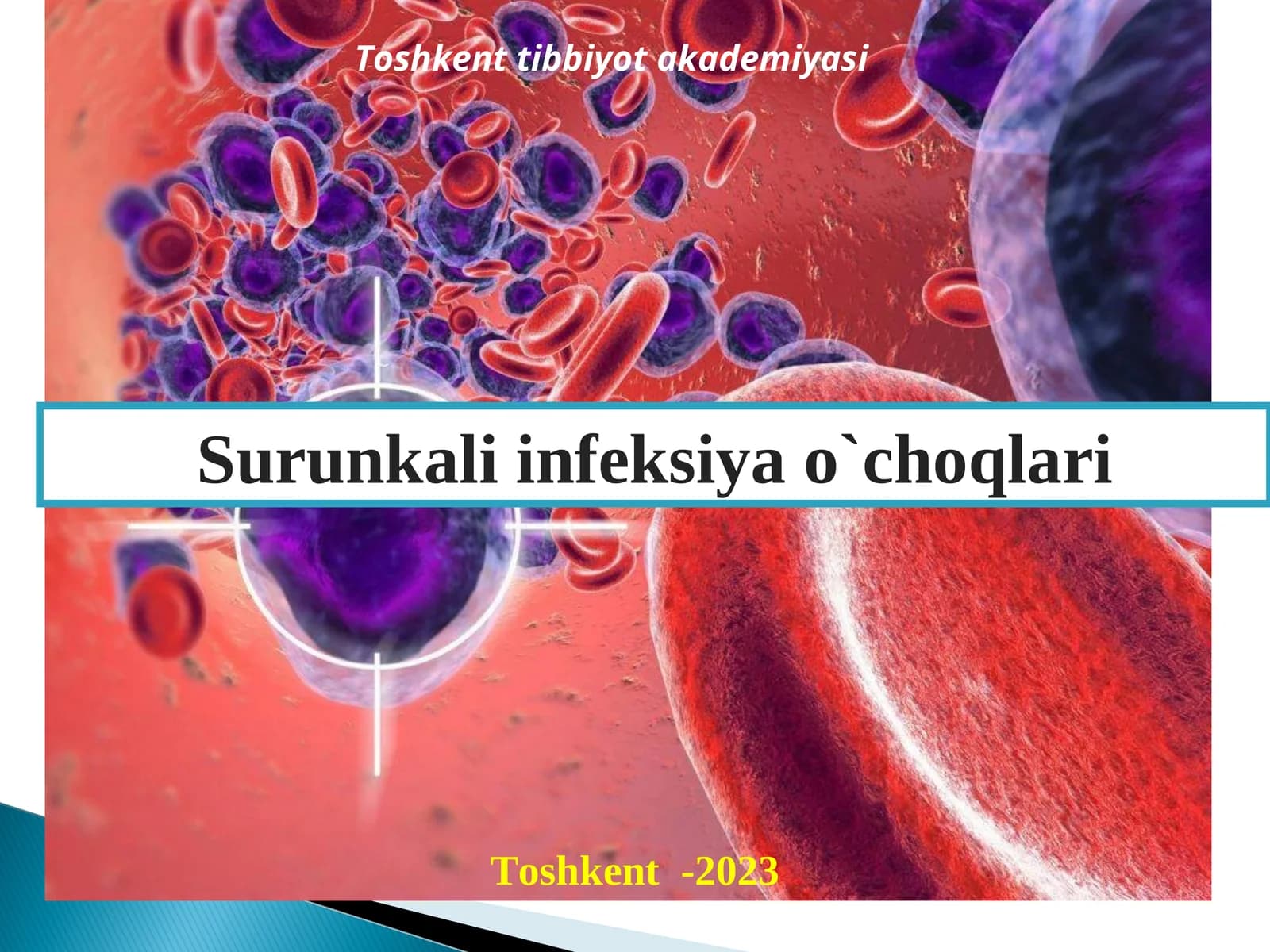Surunkali infeksiya o`choqlari