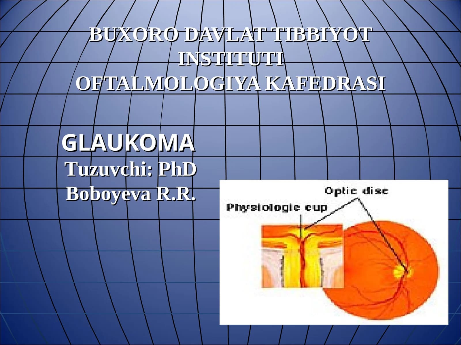 GLAUKOMA