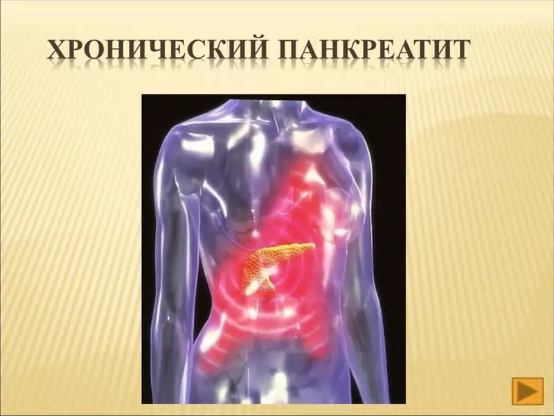 Хронического панкреатит