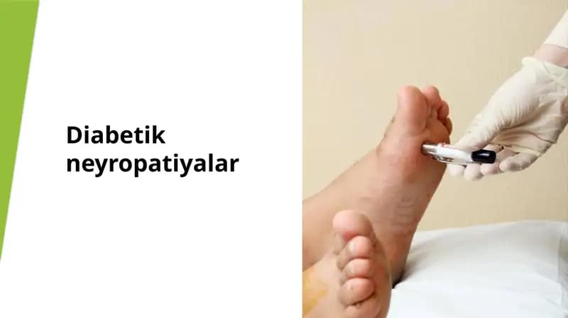 Diabetik neyropatiyalar