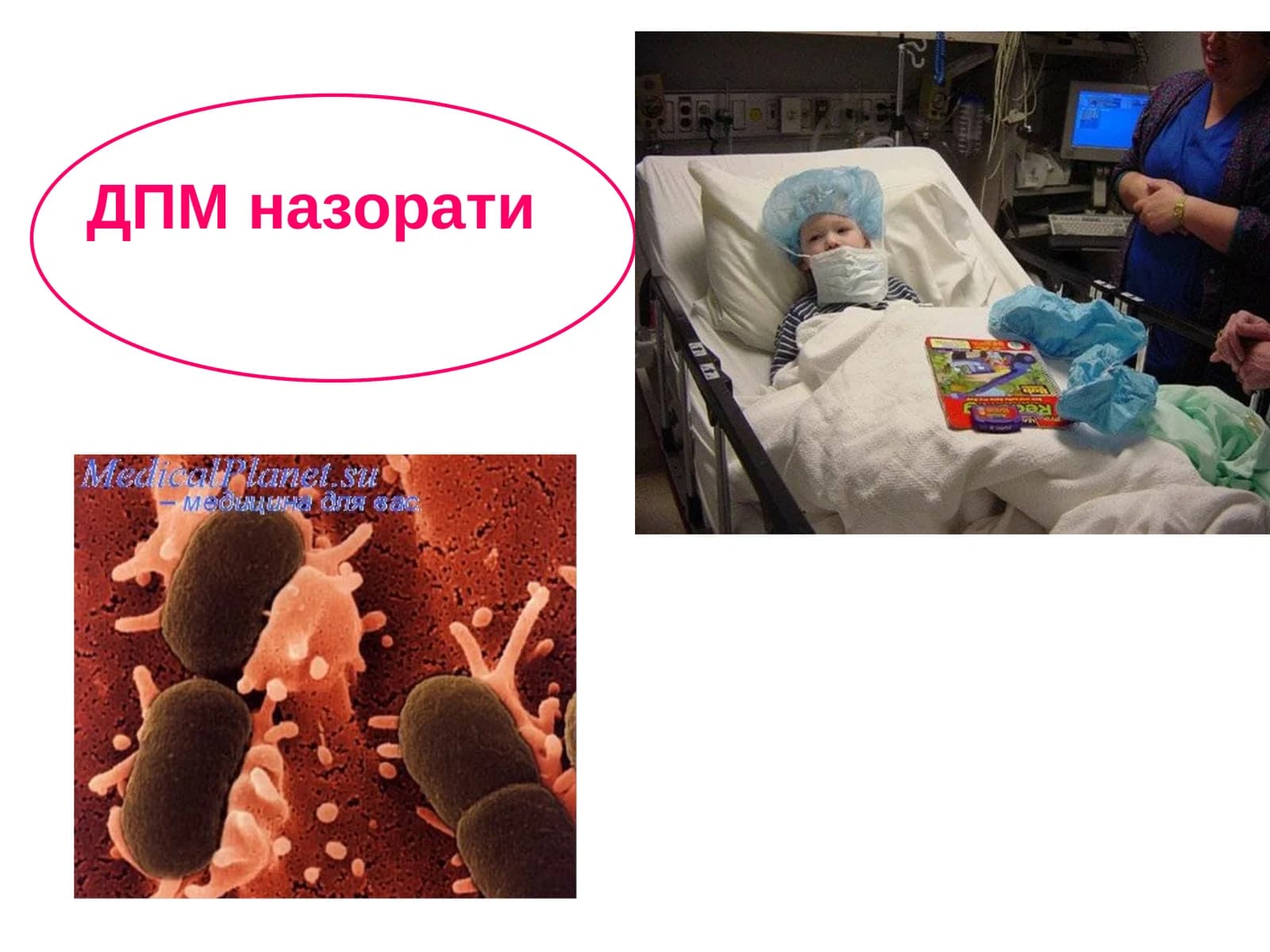 ДПМ назорати