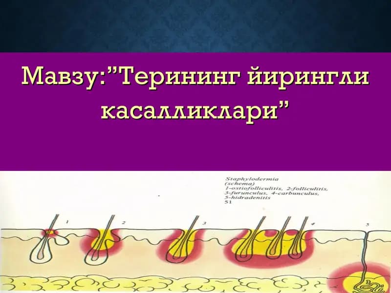 Терининг йирингли касалликлари