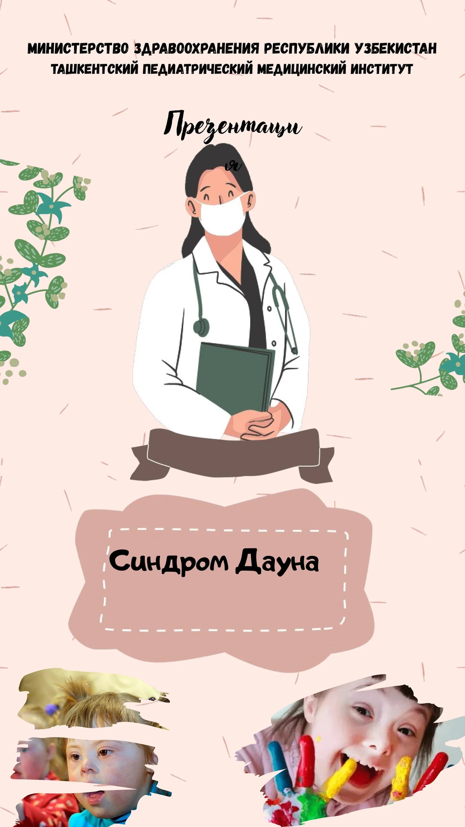 Презентация о синдроме Дауна