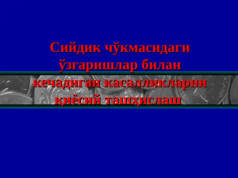 Сийдик чўкмасидаги ўзгаришлар билан кечадиган касалликлар