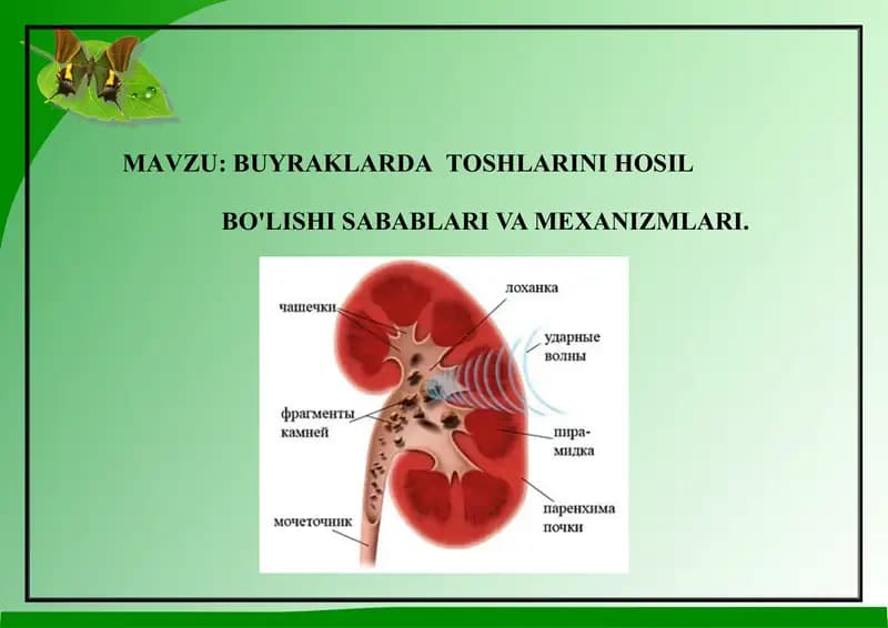 BUYRAKLARDATOSHLARINI HOSIL BO'LISHI SABABLARI VA MEXANIZMLARI