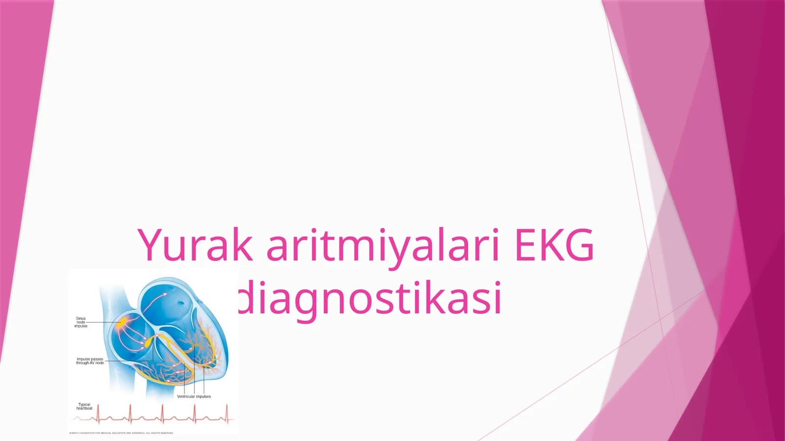 YurakaritmiyalariEKG diagnostikasi