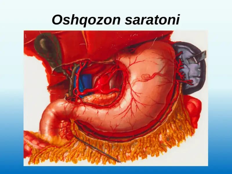 Oshqozonsaratoni