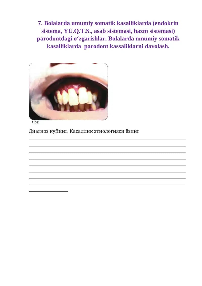 Bolalarda umumiy somatik kasalliklarda (endokrin sistema, YU.Q.T.S., asab sistemasi, hazm sistemasi) parodontdagi o‘zgarishlar