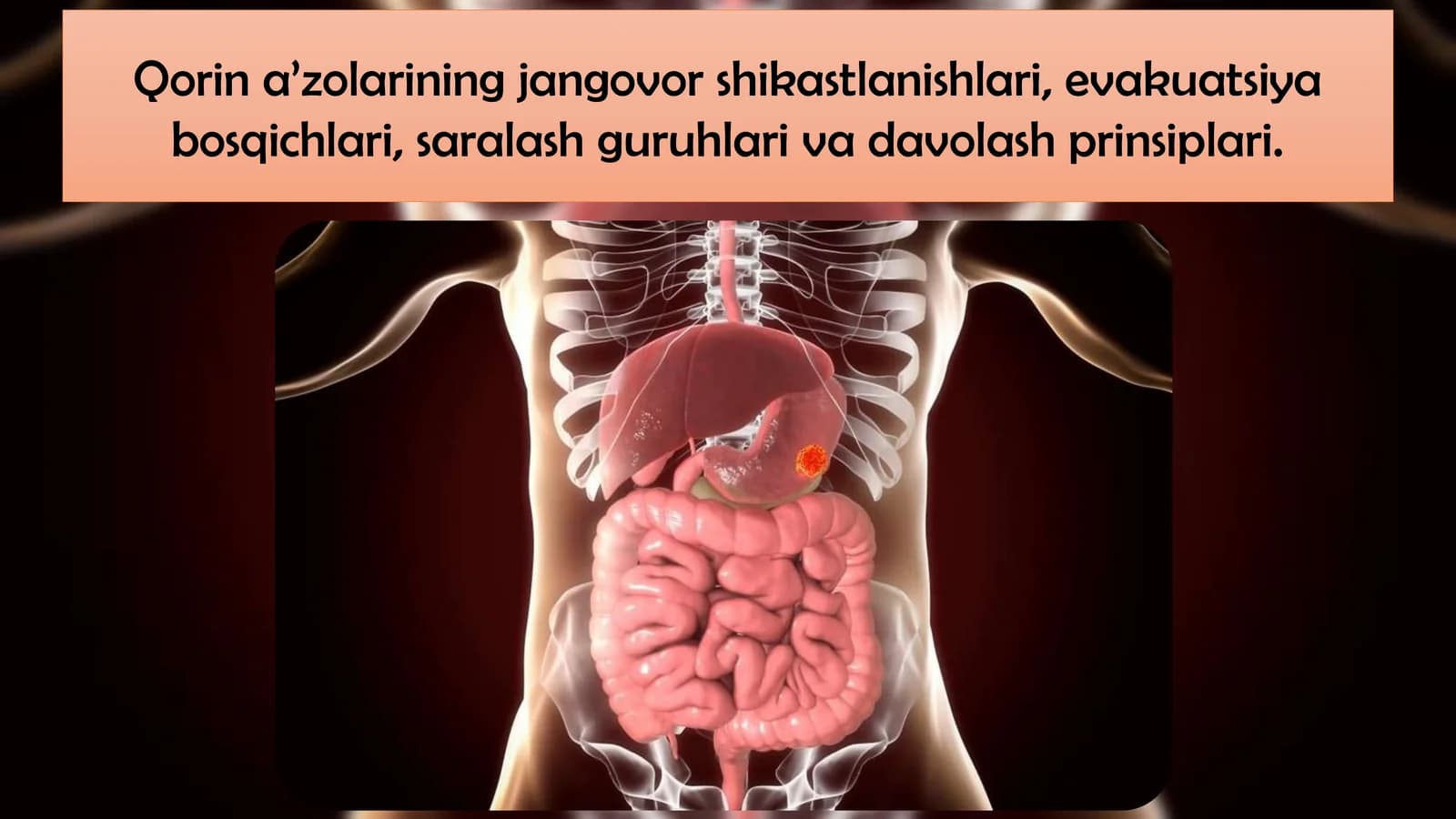Qorin a’zolarining jangovor shikastlanishlari, evakuatsiya bosqichlari, saralash guruhlari va davolash prinsiplari