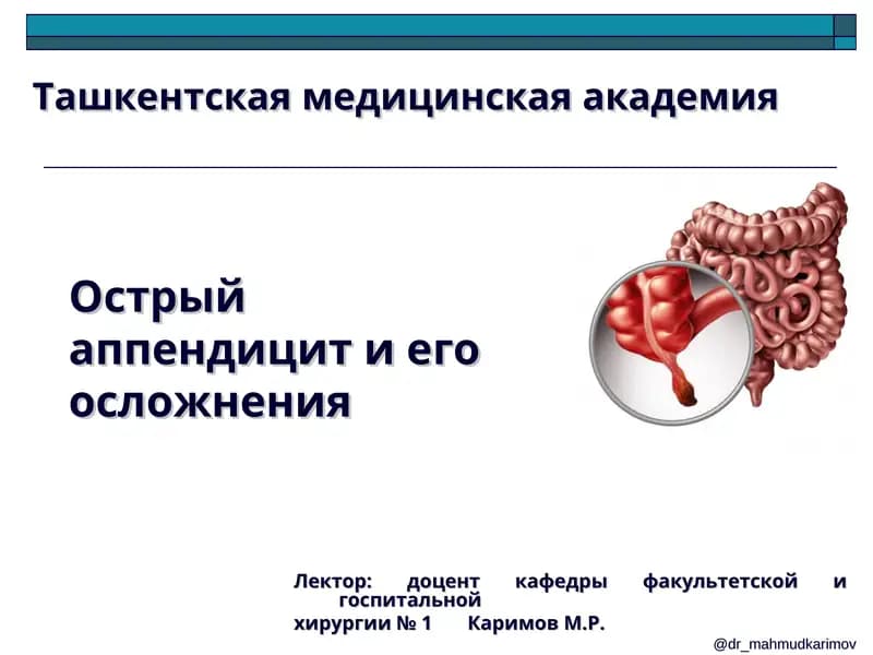 Острый аппендицит и его осложнения