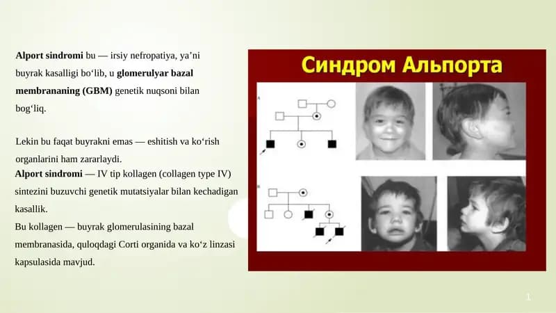Alport sindromi pptx