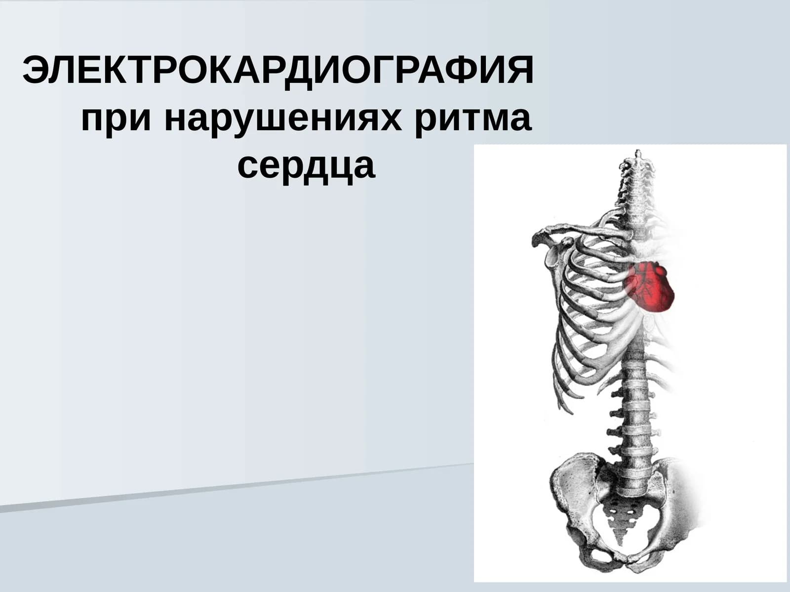 ЭЛЕКТРОКАРДИОГРАФИЯ EKG