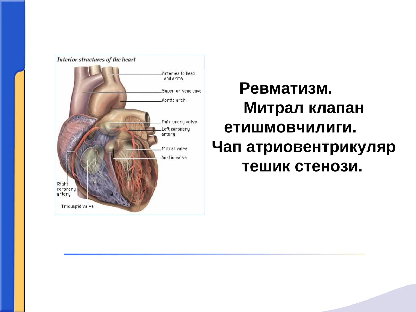 Ревматизм.Митрал клапан етишмовчилиги. Чап атриовентрикуляр тешик стенози
