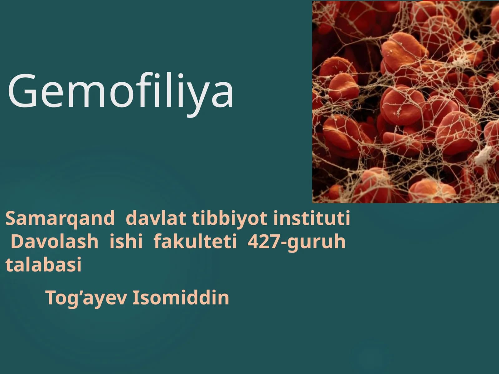 Gemofiliya