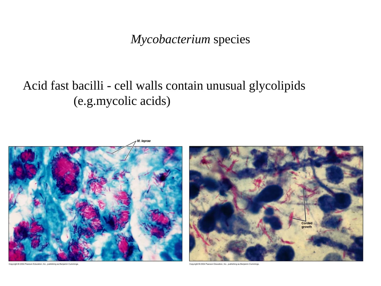 Mycobacterium species