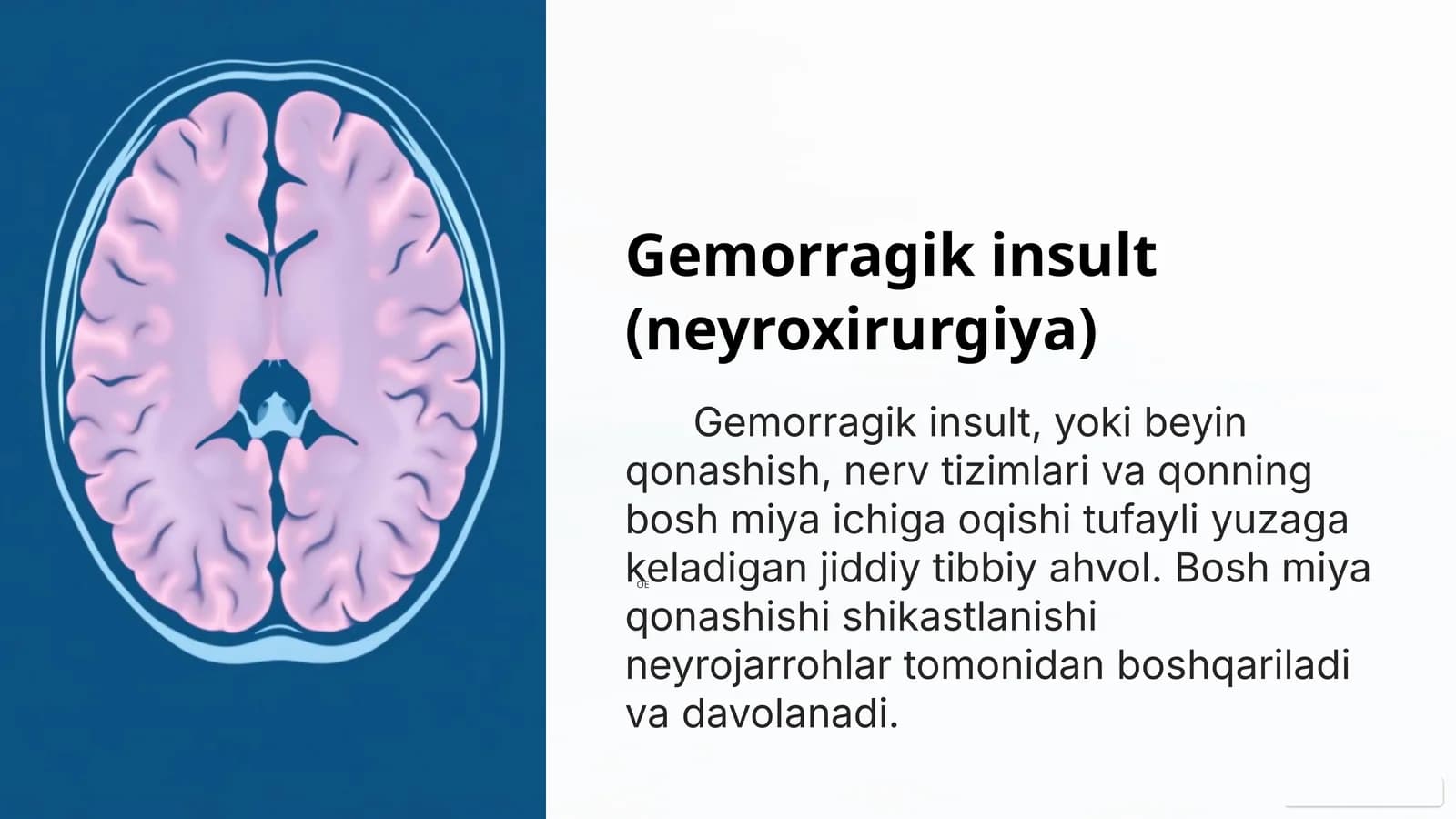 Gemorragik insult (neyroxirurgiya)