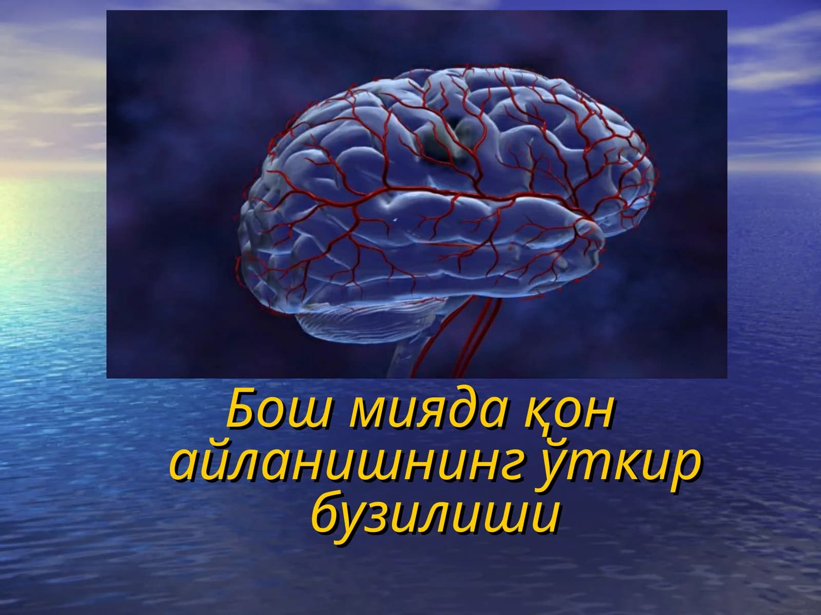 Бош миядақон айланишнинг ўткир бузилиши