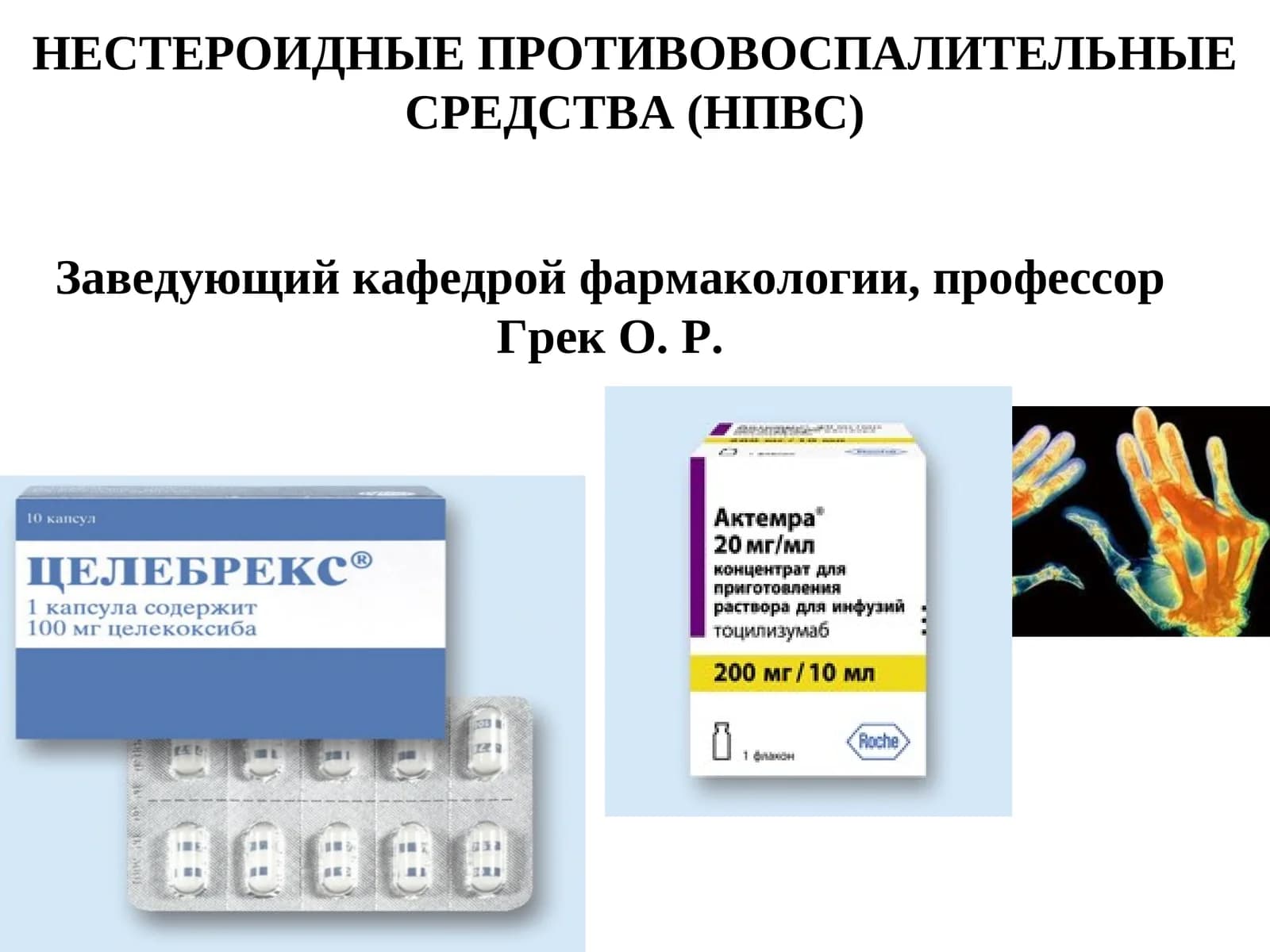 НЕСТЕРОИДНЫЕ ПРОТИВОВОСПАЛИТЕЛЬНЫЕ СРЕДСТВА (НПВС)