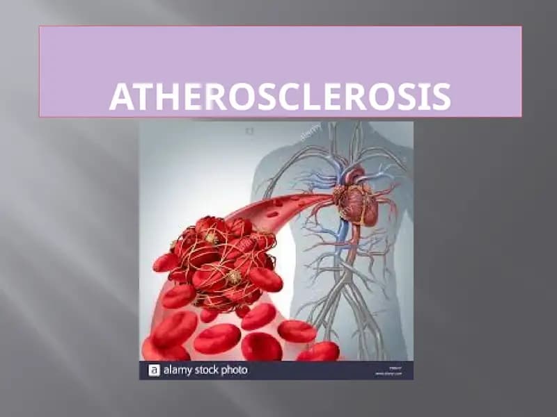 Atherosclerosis